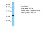 SLX1B Polyclonal Antibody