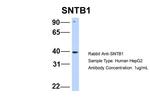 SNTB1 Antibody in Western Blot (WB)