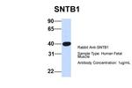 SNTB1 Polyclonal Antibody