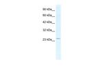 SOX14 Polyclonal Antibody