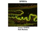 SPRR1B Polyclonal Antibody
