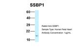 SSBP1 Antibody in Western Blot (WB)