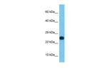 SSX2B Polyclonal Antibody