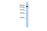 Synaptojanin 1 Polyclonal Antibody