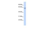 TRIM6 Polyclonal Antibody