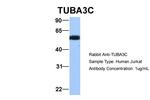 TUBA3C Antibody in Western Blot (WB)