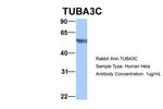 TUBA3C Antibody in Western Blot (WB)