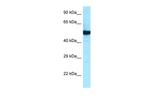 beta Tubulin 2 Polyclonal Antibody