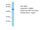 beta Tubulin 2 Antibody in Western Blot (WB)