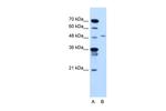 TYRP1 Polyclonal Antibody