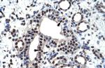 ZBTB45 Polyclonal Antibody