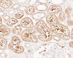 FBP1 Antibody in Immunohistochemistry (Paraffin) (IHC (P))