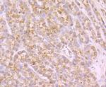 SCN9A Antibody in Immunohistochemistry (Paraffin) (IHC (P))