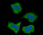 NOD3 Antibody in Immunocytochemistry (ICC/IF)