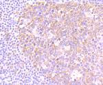 NOD3 Antibody in Immunohistochemistry (Paraffin) (IHC (P))