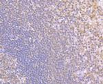 NOD3 Antibody in Immunohistochemistry (Paraffin) (IHC (P))