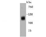 NOD3 Antibody in Western Blot (WB)