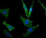 MSI2 Polyclonal Antibody
