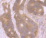 AMACR Antibody in Immunohistochemistry (Paraffin) (IHC (P))