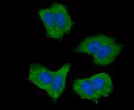 NOD3 Antibody in Immunocytochemistry (ICC/IF)