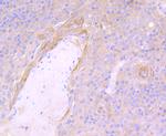 NOD3 Antibody in Immunohistochemistry (Paraffin) (IHC (P))