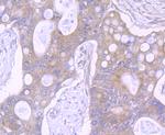 NOD3 Antibody in Immunohistochemistry (Paraffin) (IHC (P))