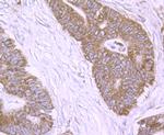 NLRP3 Antibody in Immunohistochemistry (Paraffin) (IHC (P))