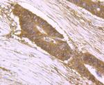 DDIT4 Antibody in Immunohistochemistry (Paraffin) (IHC (P))