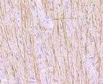 TrkA Antibody in Immunohistochemistry (Paraffin) (IHC (P))