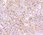 TrkA Antibody in Immunohistochemistry (Paraffin) (IHC (P))