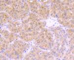 TrkA Antibody in Immunohistochemistry (Paraffin) (IHC (P))
