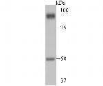 PSMA Polyclonal Antibody