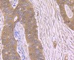 TSPO Polyclonal Antibody