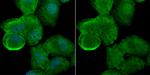 ATG7 Polyclonal Antibody