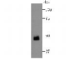 ZNF312 Polyclonal Antibody