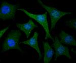 USP21 Polyclonal Antibody