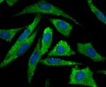 Aromatase Polyclonal Antibody