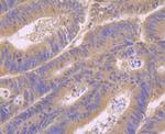 RAB7A Polyclonal Antibody