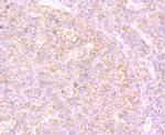 PTP1B Antibody in Immunohistochemistry (Paraffin) (IHC (P))