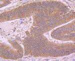 Butyrylcholinesterase Antibody in Immunohistochemistry (Paraffin) (IHC (P))