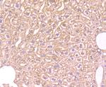 FBXL18 Polyclonal Antibody