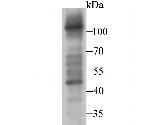 FBXL18 Antibody in Western Blot (WB)