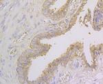 NDRG2 Polyclonal Antibody
