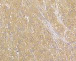 NDRG2 Antibody in Immunohistochemistry (Paraffin) (IHC (P))