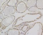 GSR Antibody in Immunohistochemistry (Paraffin) (IHC (P))