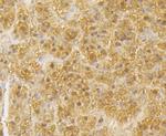 GSR Antibody in Immunohistochemistry (Paraffin) (IHC (P))