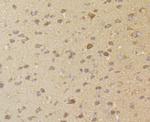 ERGIC3 Antibody in Immunohistochemistry (Paraffin) (IHC (P))
