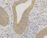 ERGIC3 Antibody in Immunohistochemistry (Paraffin) (IHC (P))