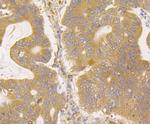 ERGIC3 Antibody in Immunohistochemistry (Paraffin) (IHC (P))