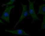 CACNG4 Polyclonal Antibody